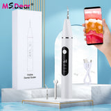 Ultrasonic Visual Dental Calculus Scaler Oral Tooth Cleaner Tartar Calculus Remover Plaque Stains Cleaner Remova Teeth Whitening