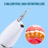 Ultrasonic Visual Dental Calculus Scaler Oral Tooth Cleaner Tartar Calculus Remover Plaque Stains Cleaner Remova Teeth Whitening