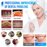 Ultrasonic Electric Dental Calculus Remover Teeth Cleaner Dental Cleaning Teeth Whitening Scaler Dental Tartar Remover Oral Care