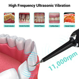Ultrasonic Teeth Cleaner Dental Tartar Remover Teeth Whitening Scaler Electric Toothbrush Dental Calculus Remover Oral Irrigator