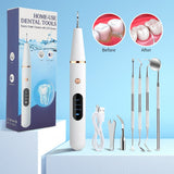 Ultrasonic Dental Scaler Electric Oral Teeth Tartar Remover Calculus Plaque Stains Cleaner Removal Teeth Whitening Tool with LED